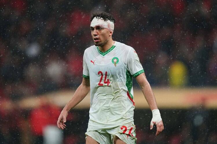 العيناوي بستفز المنتخب المغربي بتصريحات مستفزة أغضبت المغاربة قبل مباراة هايتي بكأس العالم 2026